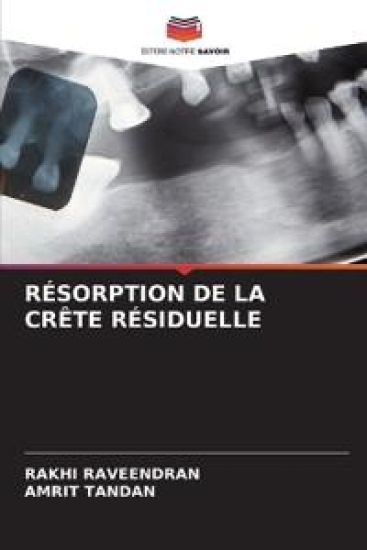 Résorption de la Crête Résiduelle