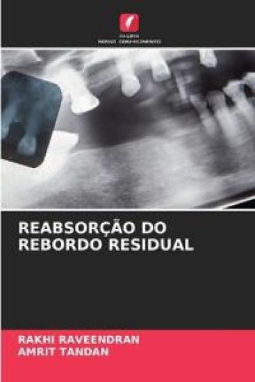 Reabsorção Do Rebordo Residual