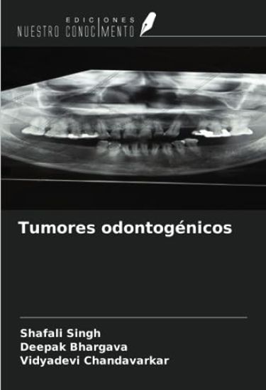 Tumores odontogénicos
