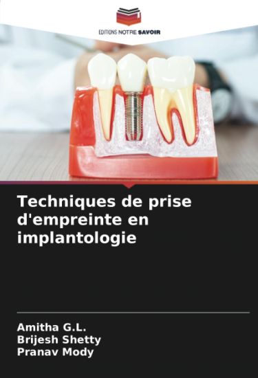 Techniques de prise d'empreinte en implantologie