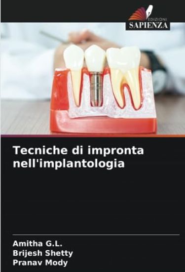 Tecniche di impronta nell'implantologia