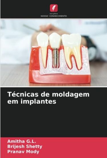 Técnicas de moldagem em implantes