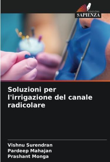 Soluzioni per l'irrigazione del canale radicolare