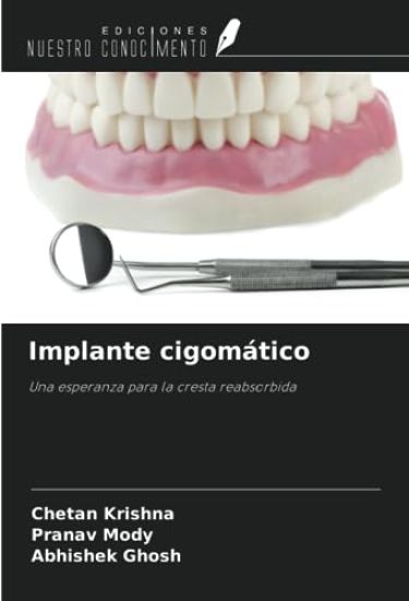 Implante cigomático