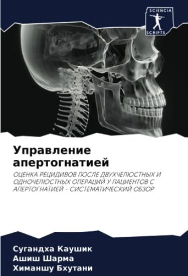 Uprawlenie apertognatiej