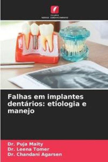 Falhas em implantes dentários