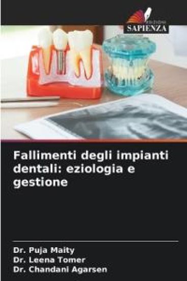 Fallimenti degli impianti dentali