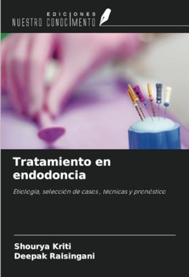 Tratamiento en endodoncia