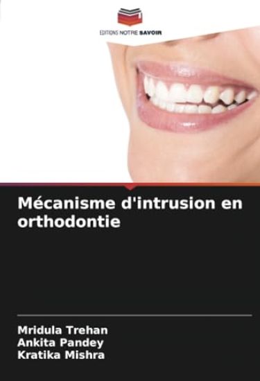 Mécanisme d'intrusion en orthodontie