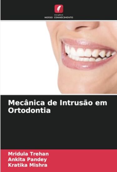 Mecânica de Intrusão em Ortodontia