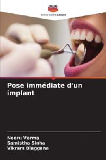 Pose immédiate d'un implant – Neeru Verma, kirjan kansikuva