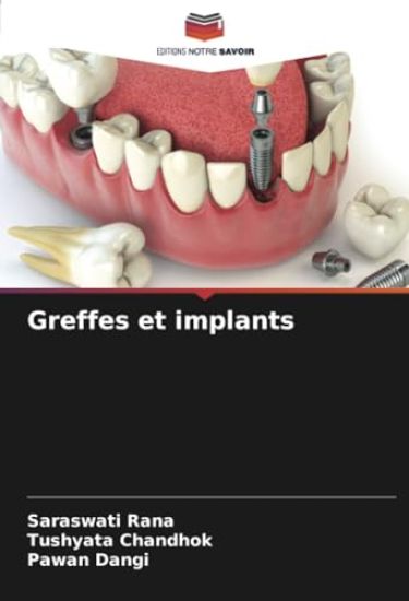 Greffes et implants