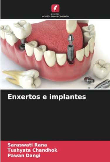 Enxertos e implantes