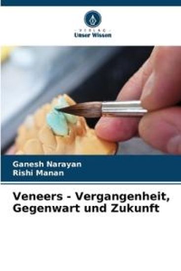 Veneers - Vergangenheit, Gegenwart und Zukunft – Ganesh Narayan, kirjan kansikuva