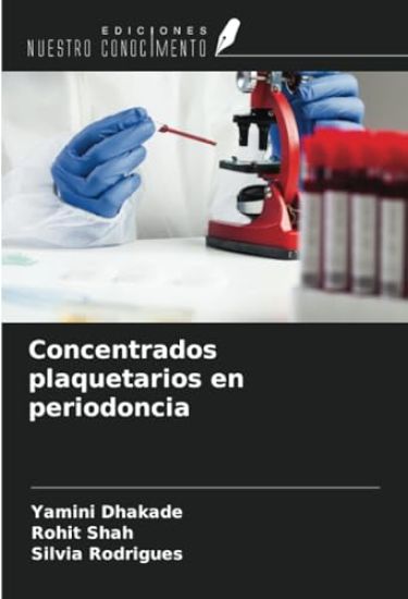 Concentrados plaquetarios en periodoncia