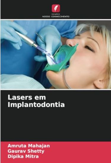 Lasers em Implantodontia