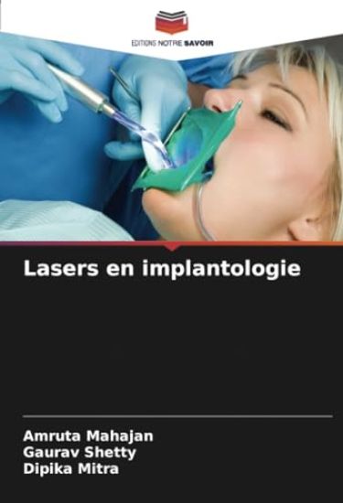Lasers en implantologie