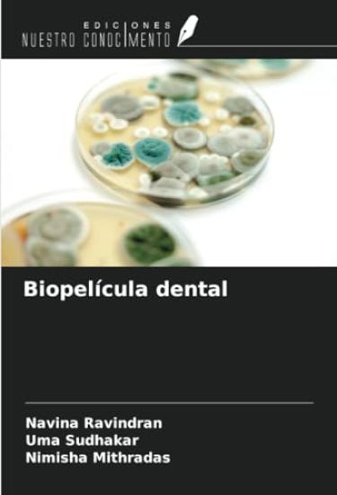 Biopelícula dental