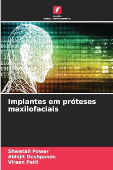 Implantes em próteses maxilofaciais