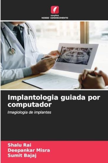 Implantologia guiada por computador