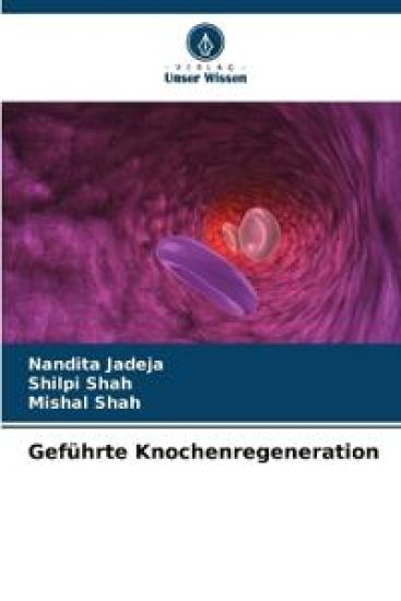 Geführte Knochenregeneration