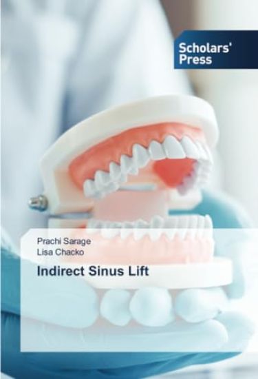 Indirect Sinus Lift