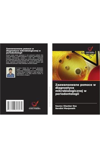 Zaawansowane pomoce w diagnostyce mikrobiologicznej w periodontologii