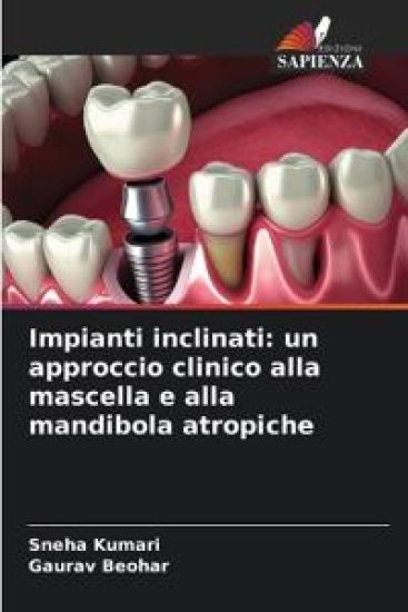 Impianti inclinati