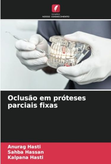 Oclusão em próteses parciais fixas