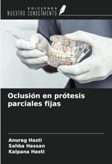 Oclusión en prótesis parciales fijas