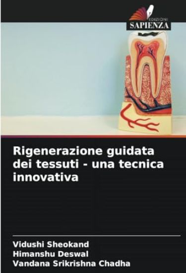 Rigenerazione guidata dei tessuti - una tecnica innovativa