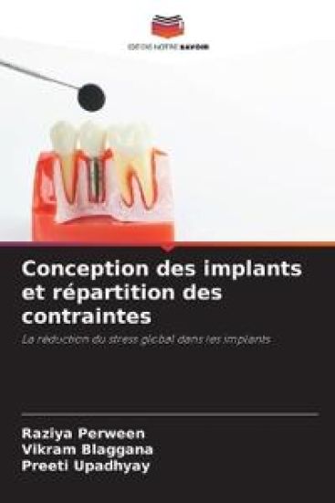 Conception des implants et répartition des contraintes – Raziya Perween, kirjan kansikuva