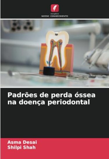 Padrões de perda óssea na doença periodontal