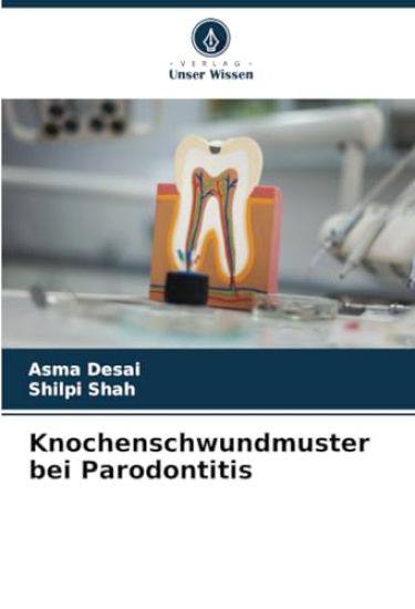 Knochenschwundmuster bei Parodontitis
