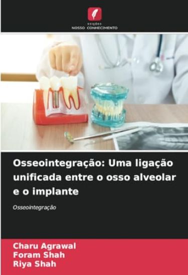 Osseointegração