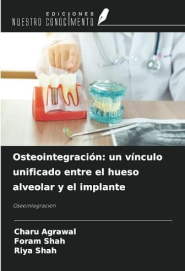 Osteointegración: un vínculo unificado entre el hueso alveolar y el implante