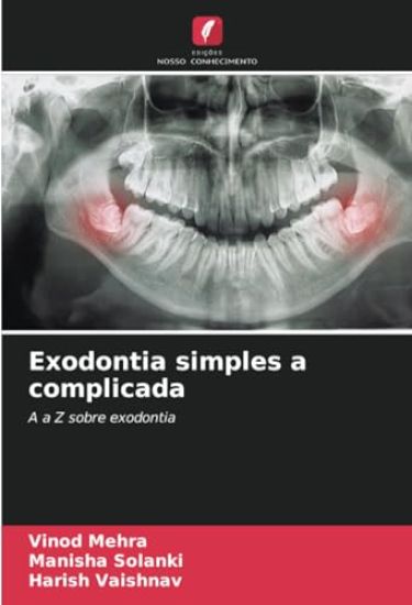 Exodontia simples a complicada