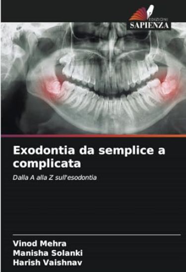 Exodontia da semplice a complicata