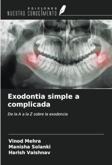 Exodontia simple a complicada