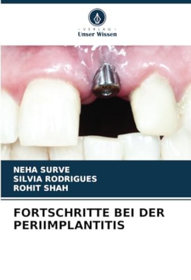 FORTSCHRITTE BEI DER PERIIMPLANTITIS