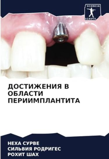 DOSTIZhENIYa V OBLASTI PERIIMPLANTITA