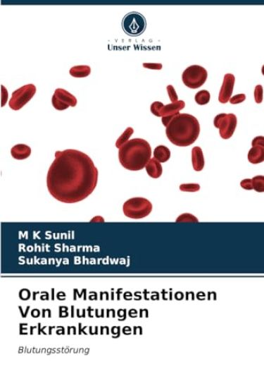 Orale Manifestationen Von Blutungen Erkrankungen – M K Sunil, kirjan kansikuva