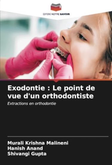 Exodontie