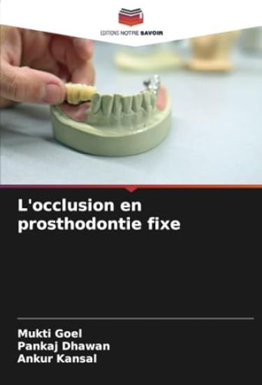 L'occlusion en prosthodontie fixe