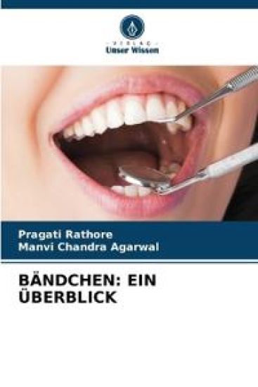 Bändchen