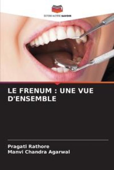 Le Frenum