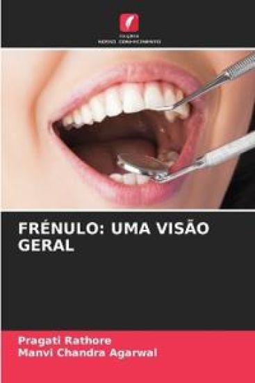 Frénulo