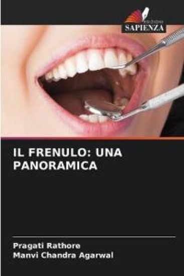 Il Frenulo