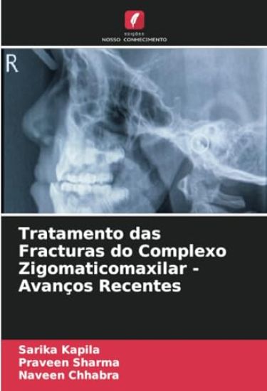 Tratamento das Fracturas do Complexo Zigomaticomaxilar - Avanços Recentes