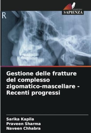 Gestione delle fratture del complesso zigomatico-mascellare - Recenti progressi